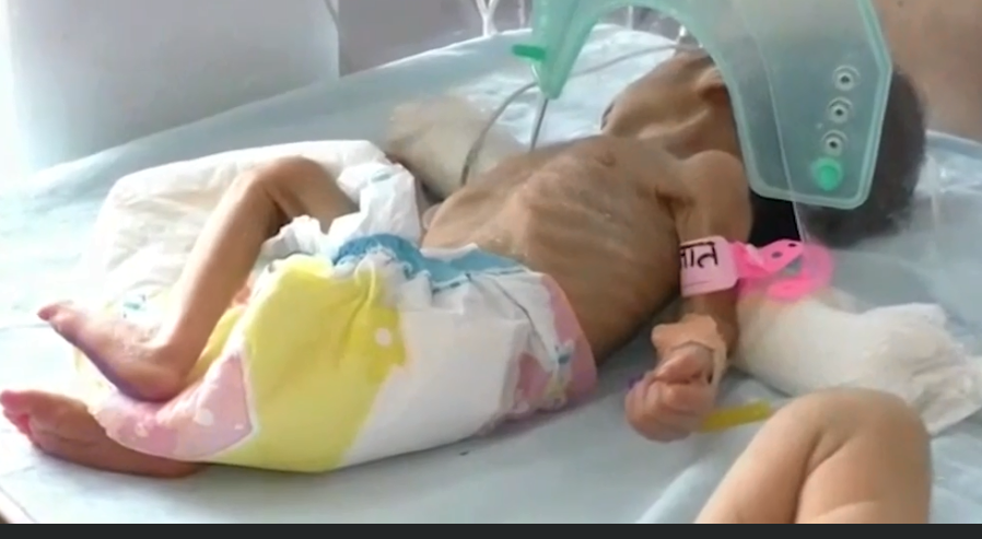 Ölmüş övladını basdırarkən torpaqdan diri uşaq tapdılar – VİDEO/FOTO